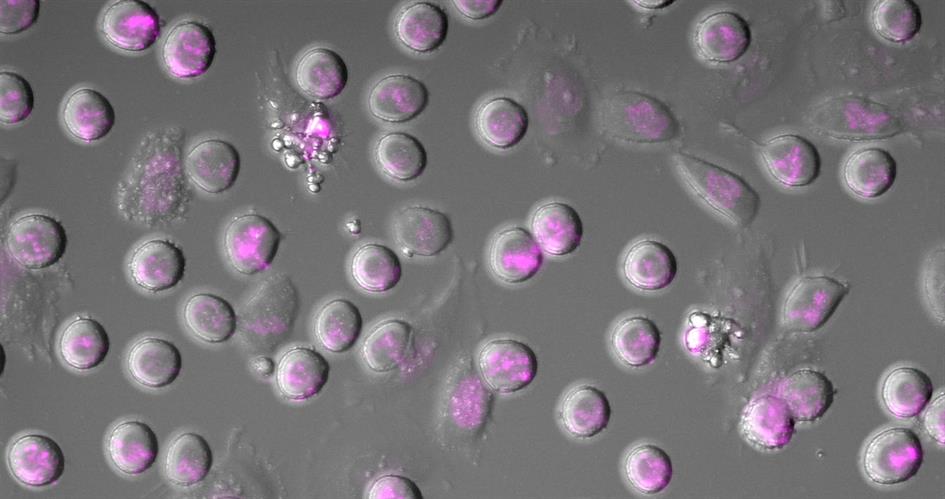 Microscopy analysis of cancer cells dying in an experiment mimicking chemotherapy in cell culture. Cells indicated with arrowhead are in the process of dying. DNA is stained in magenta.