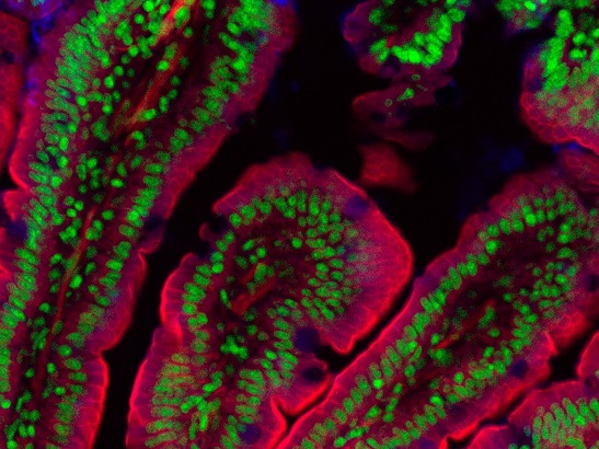 Caption for: 'Gut bugs' can drive prostate cancer growth and treatment resistance