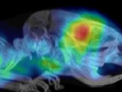 PET scan of a mouse with a brain tumour