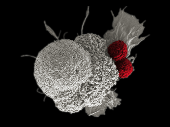 Caption for: ESMO 2021: Immunotherapy combination could be alternative to ‘Extreme’ chemotherapy in some head and neck cancers