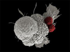 Oral squamous cancer cell (white) being attacked by two cytotoxic T cells (red)
