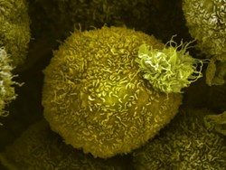 Scientists discover mechanism controlling spread of pancreatic cancer