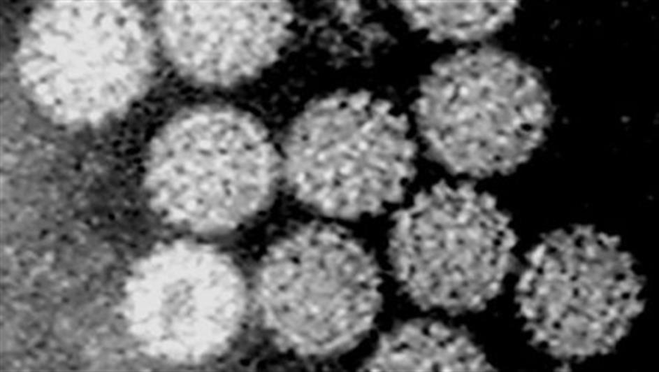 Electronic Microscope image of Papilloma Virus