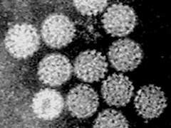 Electron Microscope image of Papilloma Virus