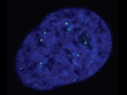 Researchers gain fascinating new insights into chromosome shortening – and identify new potential cancer drug targets