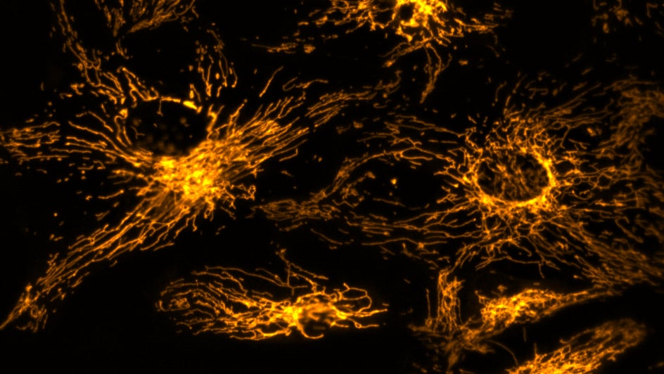  Image showing retina pigment epithelial cells that have been stained for reactive oxygen species