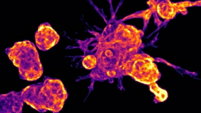 Melanoma cells in their rounded form, taken using stage-scanning oblique plane microscopy 
