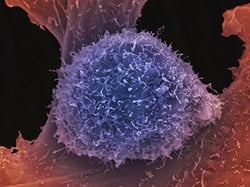 Men’s Health Awareness Month: 12 months of progress into male cancer research at the ICR