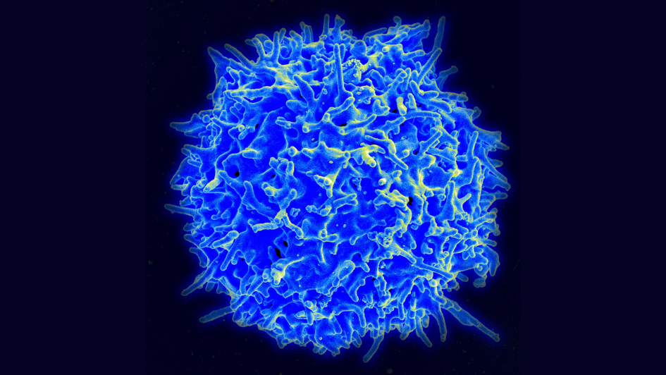 Human T cell.