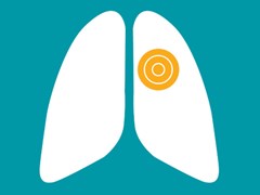 Targeted lung cancer treatments