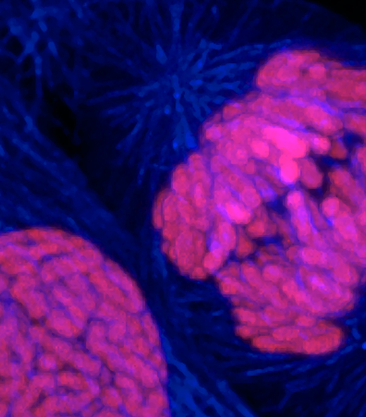 A new understanding of how cells die