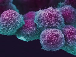 AACR 2021: Cancer discoveries on a virtual platform