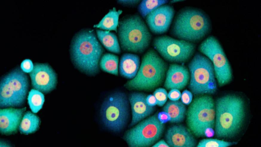 Breast cancer cells stained for DNA (red), NFkB (green), and a reactive oxygen species probe (blue). Julia Sero  the ICR, 2011