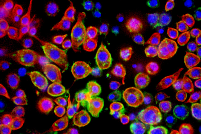 Melanoma cells (Dr Chris Bakal / the ICR)