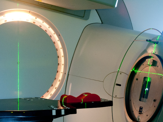Caption for: Shorter radiotherapy course reduces risk of bladder cancer returning